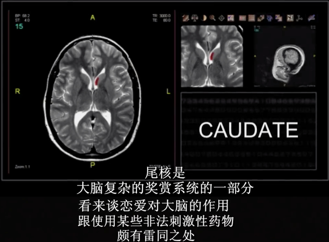 恋爱脑女生给男生的感觉（女生恋爱脑的表现）